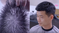 男士超薄假發(fā)案例視頻>>