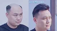 男士假發(fā)客戶案例視頻>>