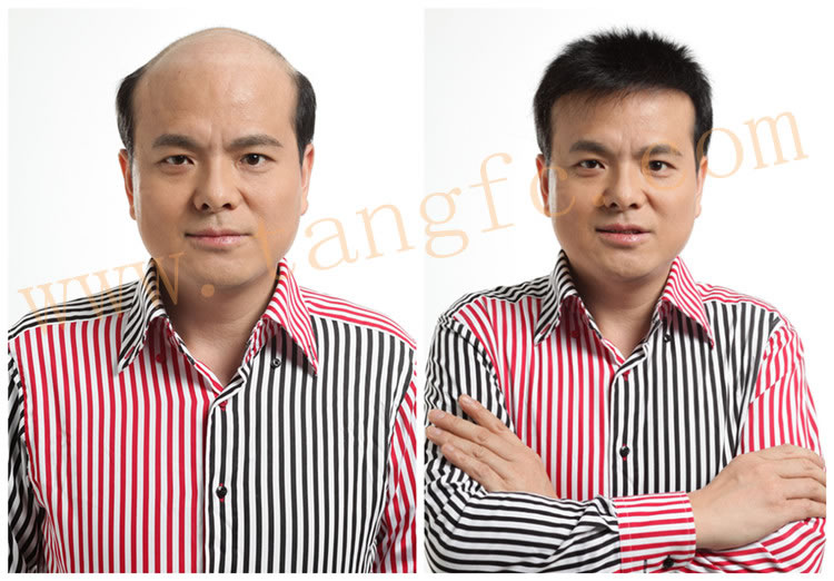 合肥織發(fā)補(bǔ)發(fā)去哪里好？