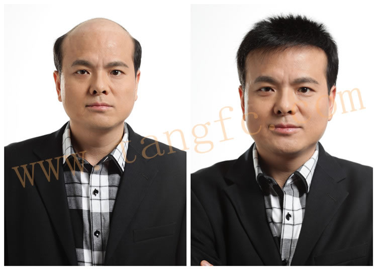 李開復(fù)患淋巴癌，現(xiàn)代人透支健康、過早脫發(fā)引人深思