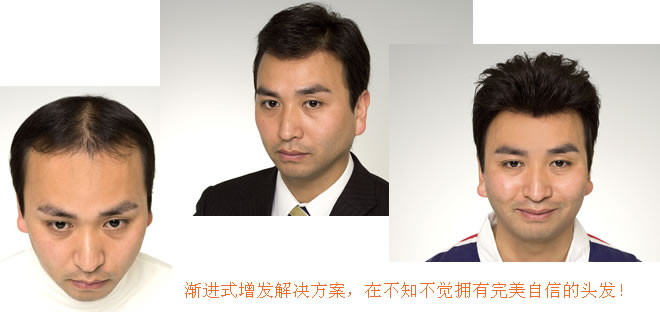 怎么洗頭才不容易脫發(fā)？