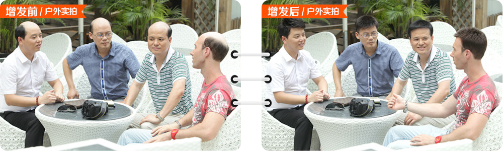 黑發(fā)變白怎么辦？