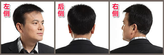 前額兩邊頭發(fā)稀疏怎么辦？看了你就知道怎么解決！