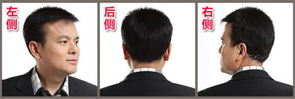 男人頭發(fā)稀少應(yīng)該怎么解決？