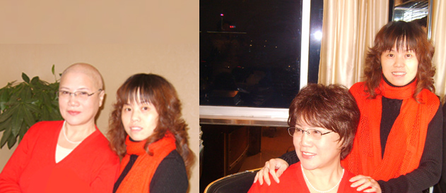 女士脂溢性脫發(fā)也可以用無痕織發(fā)補發(fā)嗎？