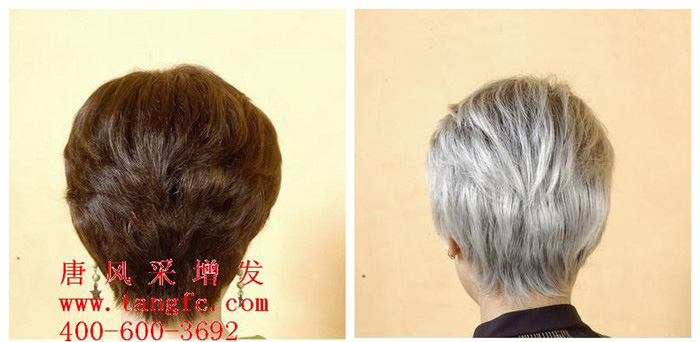 白發(fā)變黑的小竅門有哪些？青年白發(fā)怎么辦？