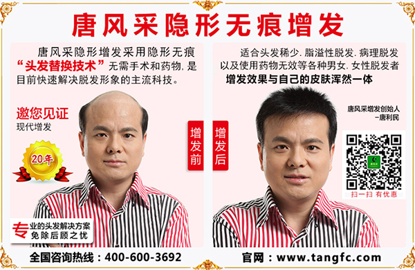 禿頂植發(fā)要多少錢？脫發(fā)禿頂又與頭皮屑有什么關(guān)聯(lián)？