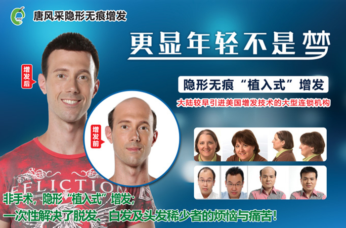 斑禿不要怕，小編帶您見證唐風(fēng)采效果！