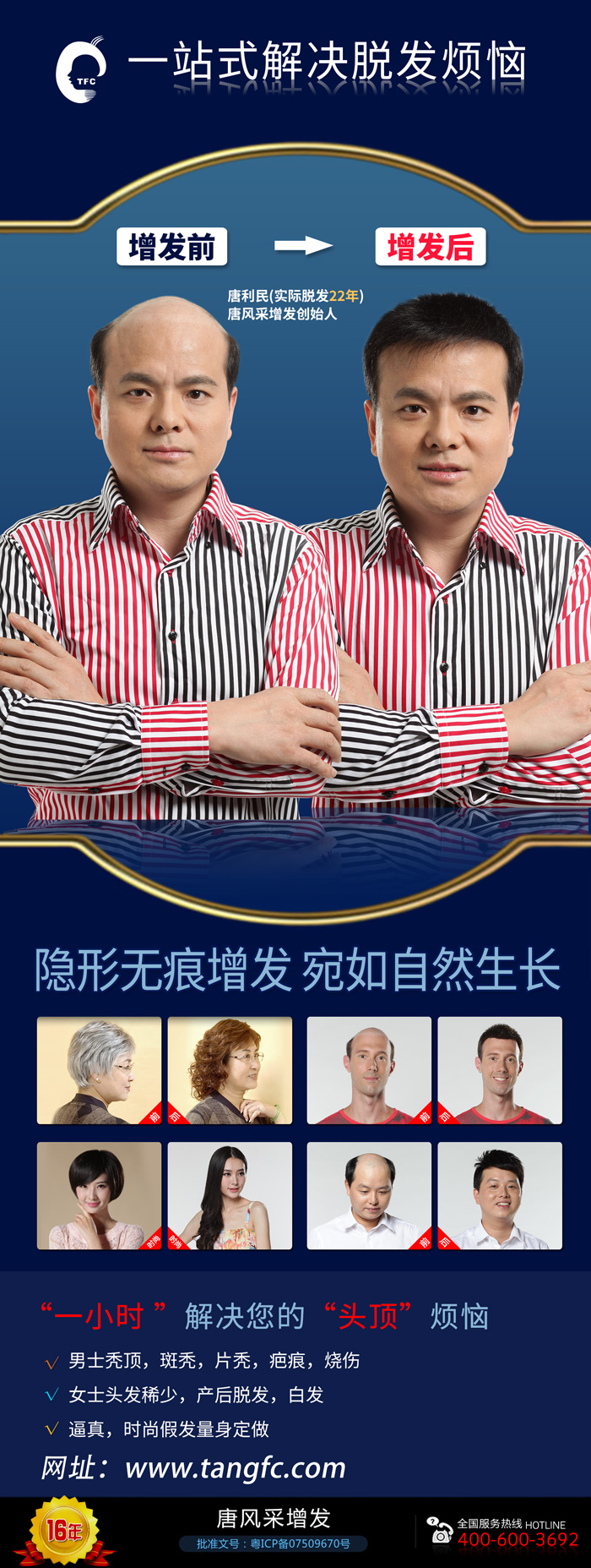 無(wú)痕補(bǔ)發(fā)價(jià)格是多少？哪里補(bǔ)發(fā)技術(shù)比較好？
