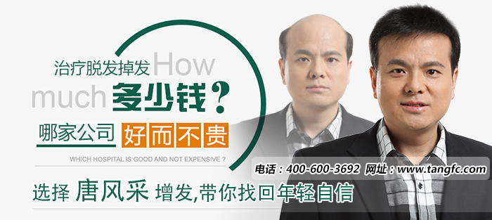 織發(fā)哪個牌子好 織發(fā)哪個牌子好 禿頂可以進(jìn)行織發(fā)嗎