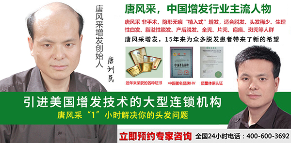 早禿怎么辦？哪里能進(jìn)行男士頭發(fā)加密？