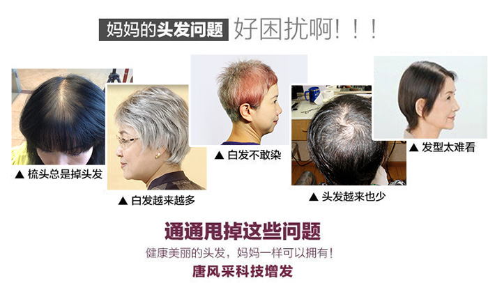 日常習慣要注意，防火防盜防白發(fā)脫發(fā)！