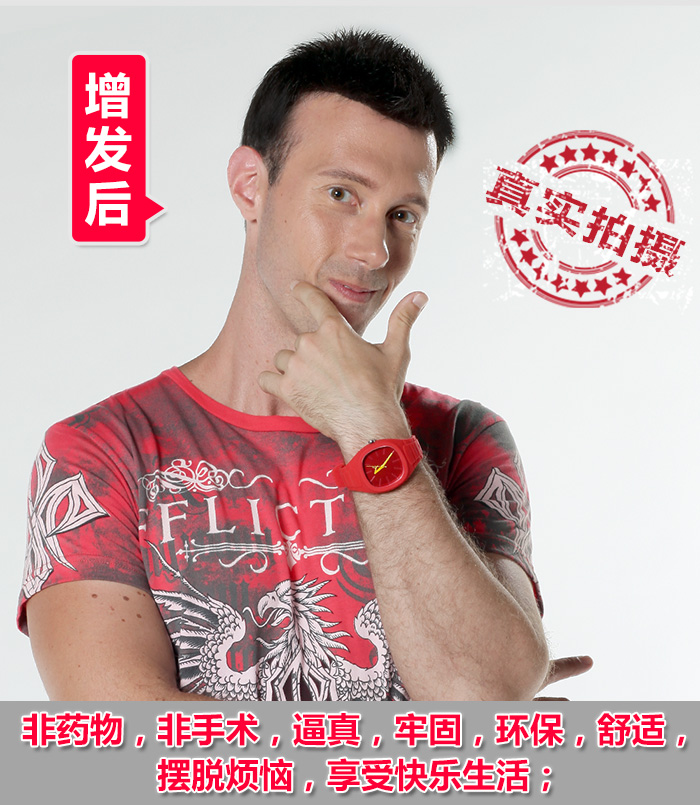 脫發(fā)真的沒救了嗎？教你如何逆襲