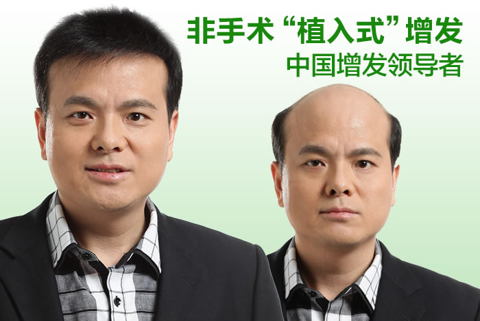 頭發(fā)稀少用什么？預(yù)防與解決需要懂這些