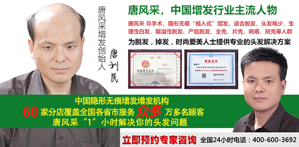 大連自然織發(fā)找哪家好？脫發(fā)復原就靠這個了！