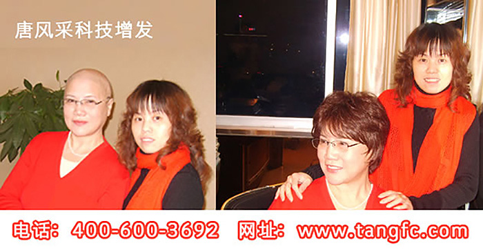 女士假發(fā)什么牌子好？高端假發(fā)領(lǐng)導(dǎo)者就是這個(gè)牌子！
