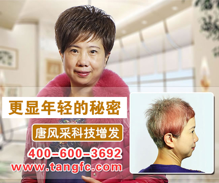 白頭發(fā)怎么變黑？靠譜小編帶你走向康莊大道