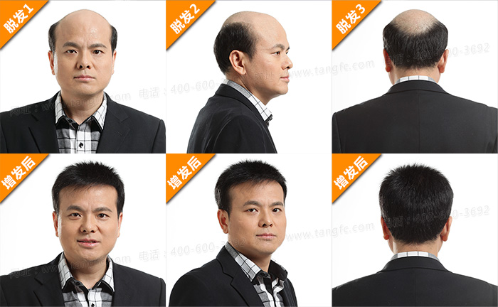 哈爾濱哪有可以定做男士假發(fā)的？