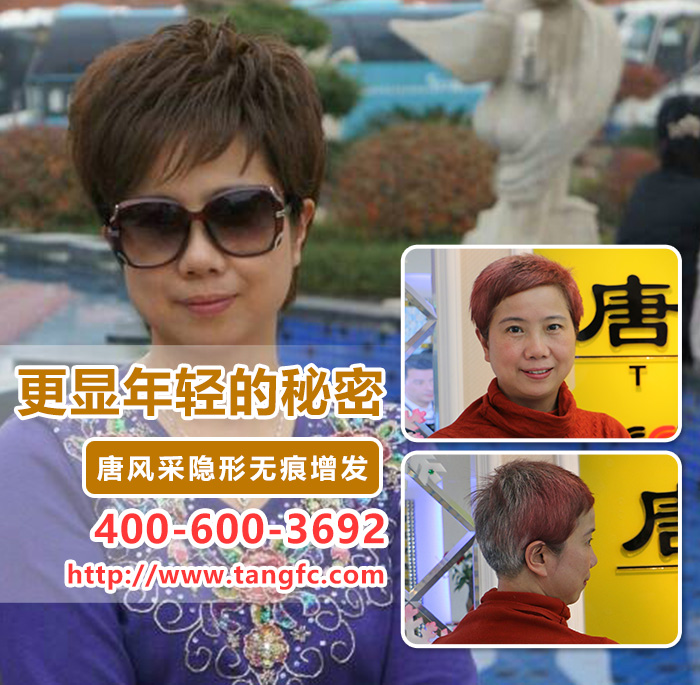 頭發(fā)稀少怎么補發(fā)？2016補發(fā)新型技術(shù)！