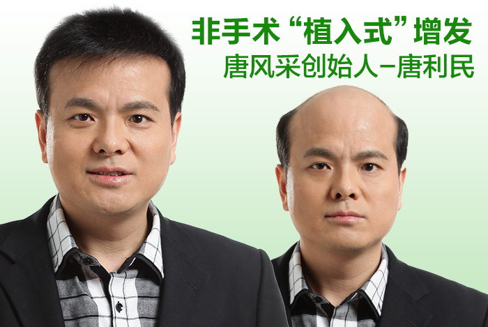 南寧好的織發(fā)店服務(wù)售后有保障嗎？