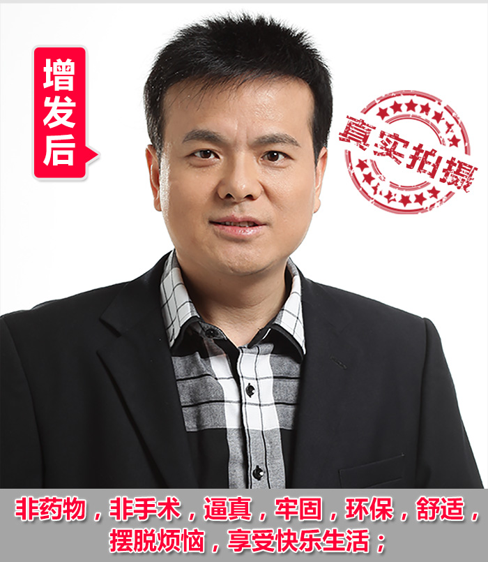 脫發(fā)禿頂?shù)目诵恰鹕剿饺硕ㄖ聘叨思侔l(fā)！