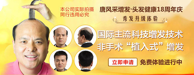 蘇州高檔假發(fā)定制 蘇州高檔假發(fā)定制 專業(yè)解決頭發(fā)形象問題