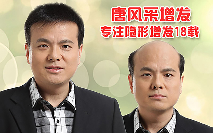 哪種男士發(fā)型好看？掉頭發(fā)怎么辦