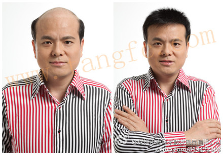 如何選擇男士假發(fā)專賣店？這類人易得雄脫