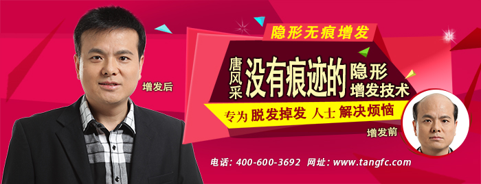 在佛山有哪些織發(fā)補(bǔ)發(fā)店？唐風(fēng)采這家怎么樣？