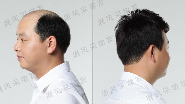 拉薩哪里有假發(fā)專賣店？效果逼真質量好的是哪家？