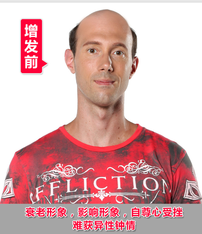 南通真人發(fā)假發(fā)哪里好？