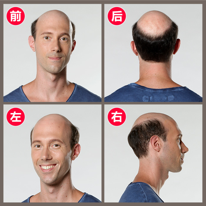 金華織發(fā)哪里效果最好？論效果當(dāng)屬唐風(fēng)采增發(fā)！