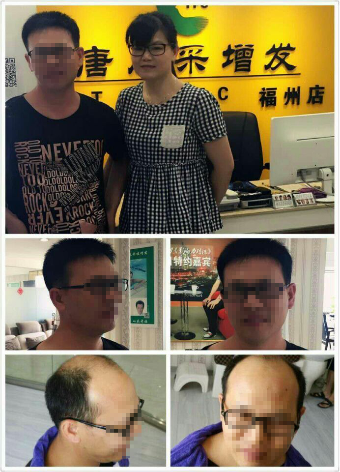 脫發(fā)后“藍瘦、香菇”，那你還在等什么？