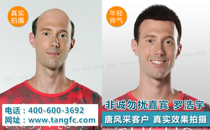 明星很逼真的假發(fā)，渾然天成的感覺是怎么做到的？