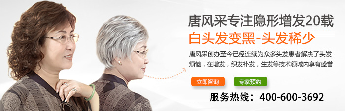 長沙假發(fā)什么牌子好？千萬別貪小便宜吃了大虧