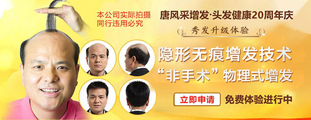大同白發(fā)人看過來，白發(fā)多愛脫發(fā)1小時就搞定了