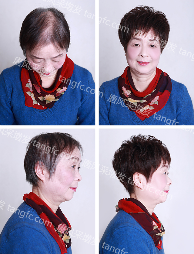 拉薩買隱形假發(fā)哪家好？唐風(fēng)采增發(fā)技術(shù)好！
