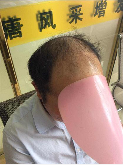 沒有對比就沒有傷害，唐風(fēng)采增發(fā)品質(zhì)看得見！