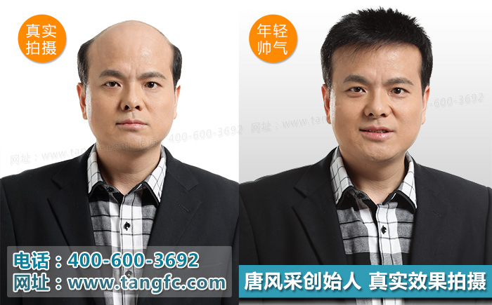 奧尼爾戴白發(fā)開懟，小伙伴們千萬別模仿！