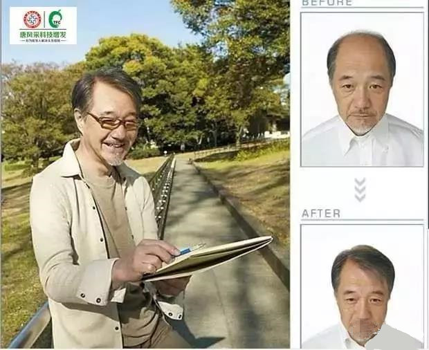 來自NASA的黑科技生發(fā)頭盔，禿頂有救了？