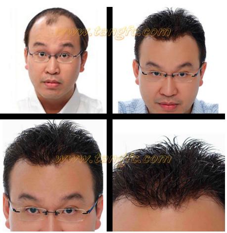 來自NASA的黑科技生發(fā)頭盔，禿頂有救了？