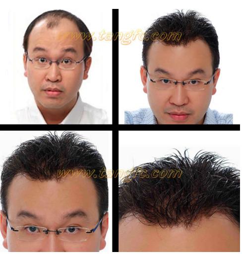 哪家假發(fā)適合脫發(fā)人？金華哪里有假發(fā)專賣店？