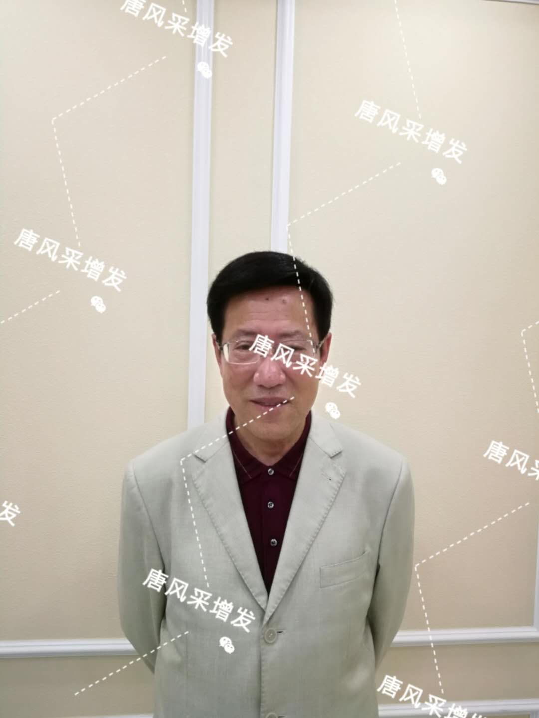 脫發(fā)禿頂成中年男人標(biāo)配？唐風(fēng)采增發(fā)讓您風(fēng)采始終如一