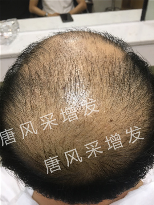 今天咱不看廣告宣傳了，唐風(fēng)采真實(shí)效果，上圖上視頻