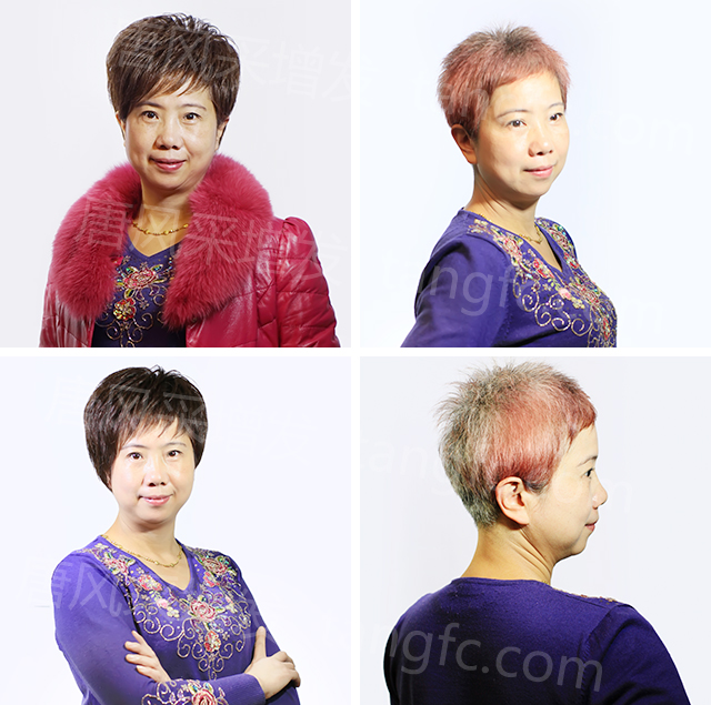 柳州織發(fā)假發(fā)訂做，效果杠杠不負(fù)好時(shí)光！