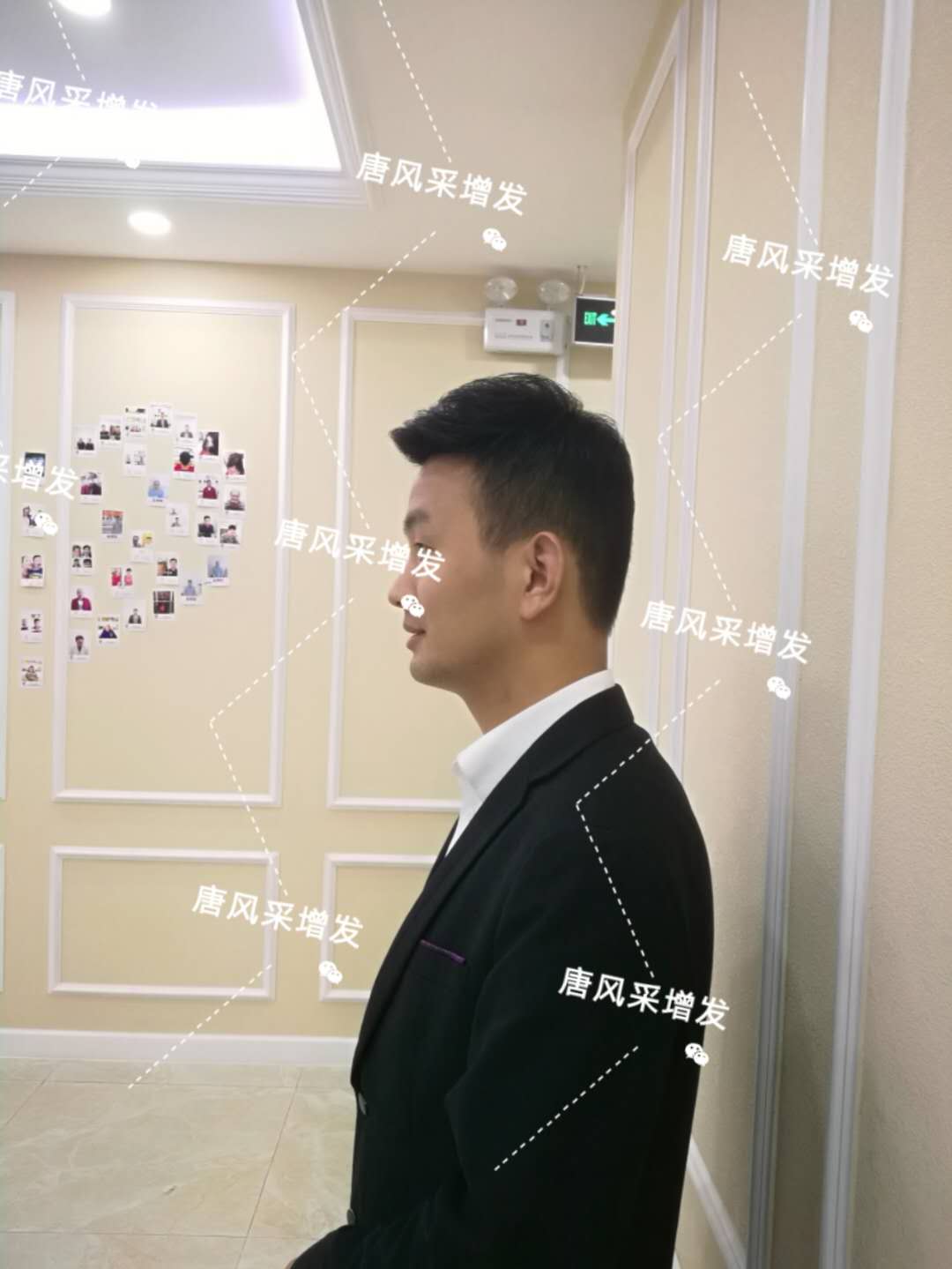 輸了頭發(fā)不能輸氣質，看帥哥的逆襲之路！