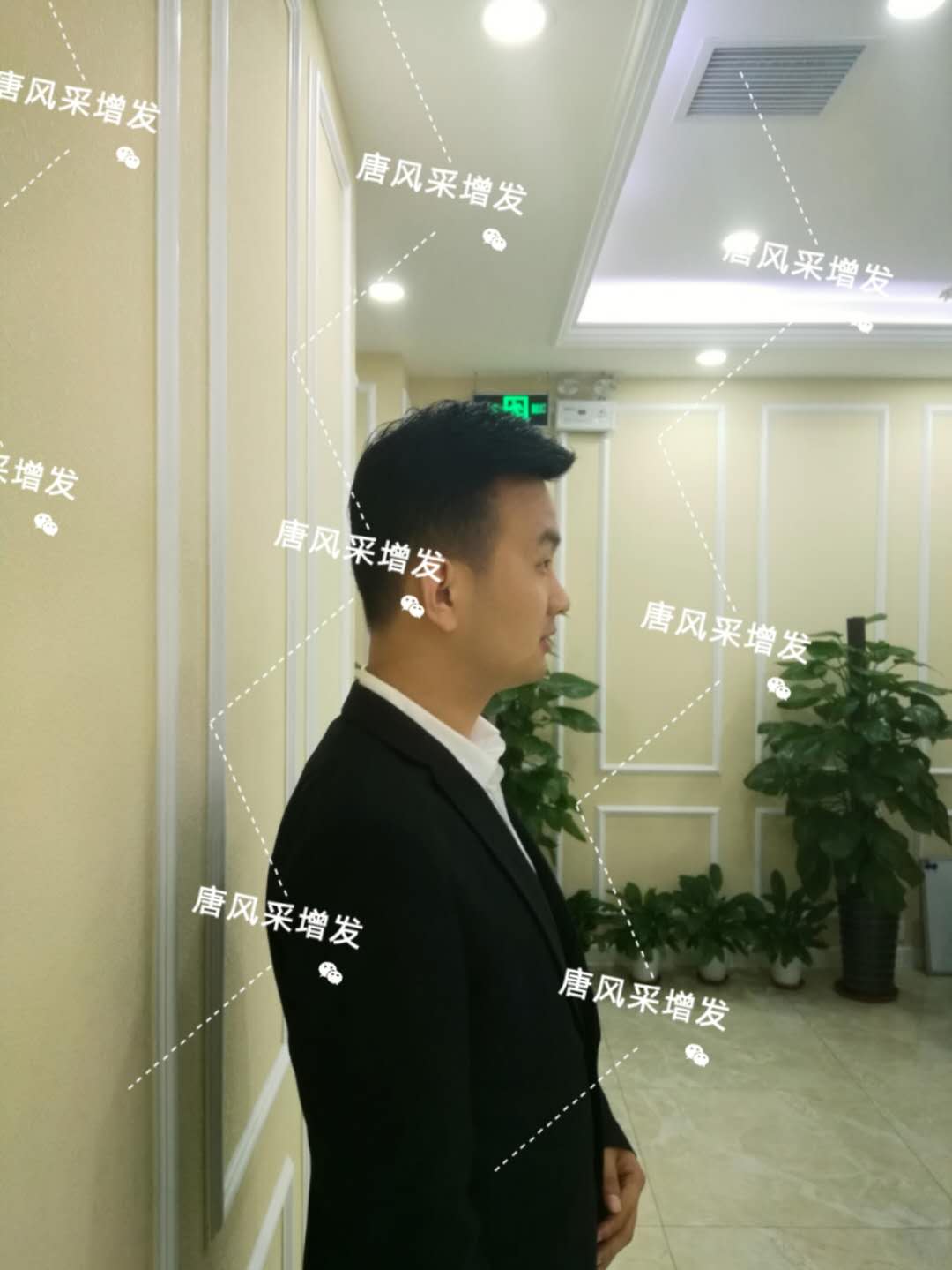 輸了頭發(fā)不能輸氣質，看帥哥的逆襲之路！