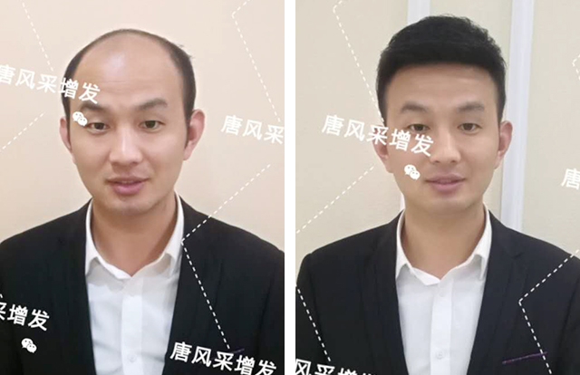 輸了頭發(fā)不能輸氣質，看帥哥的逆襲之路！