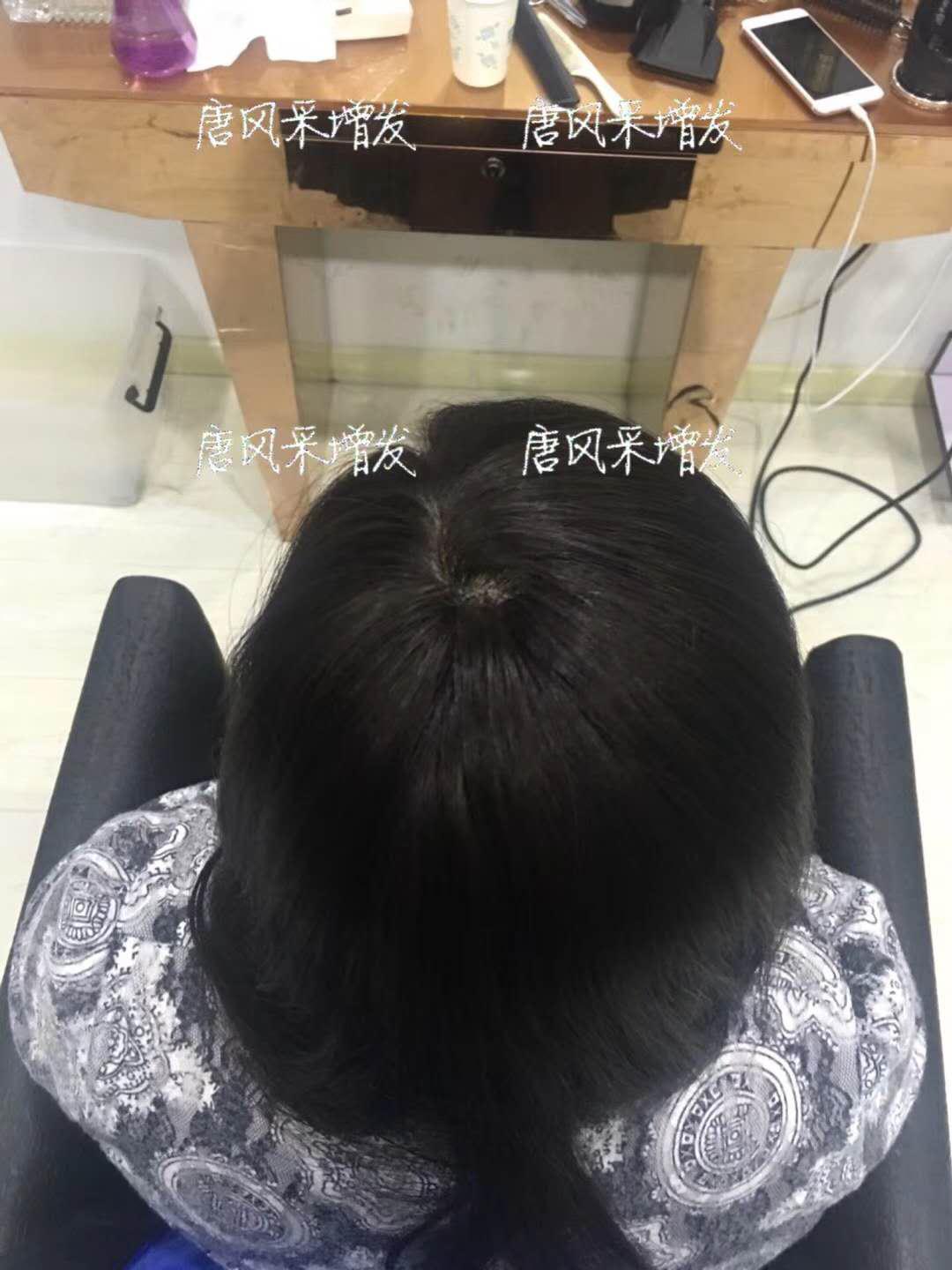 生發(fā)了這么久，但凡有效果的也該有些跡象了