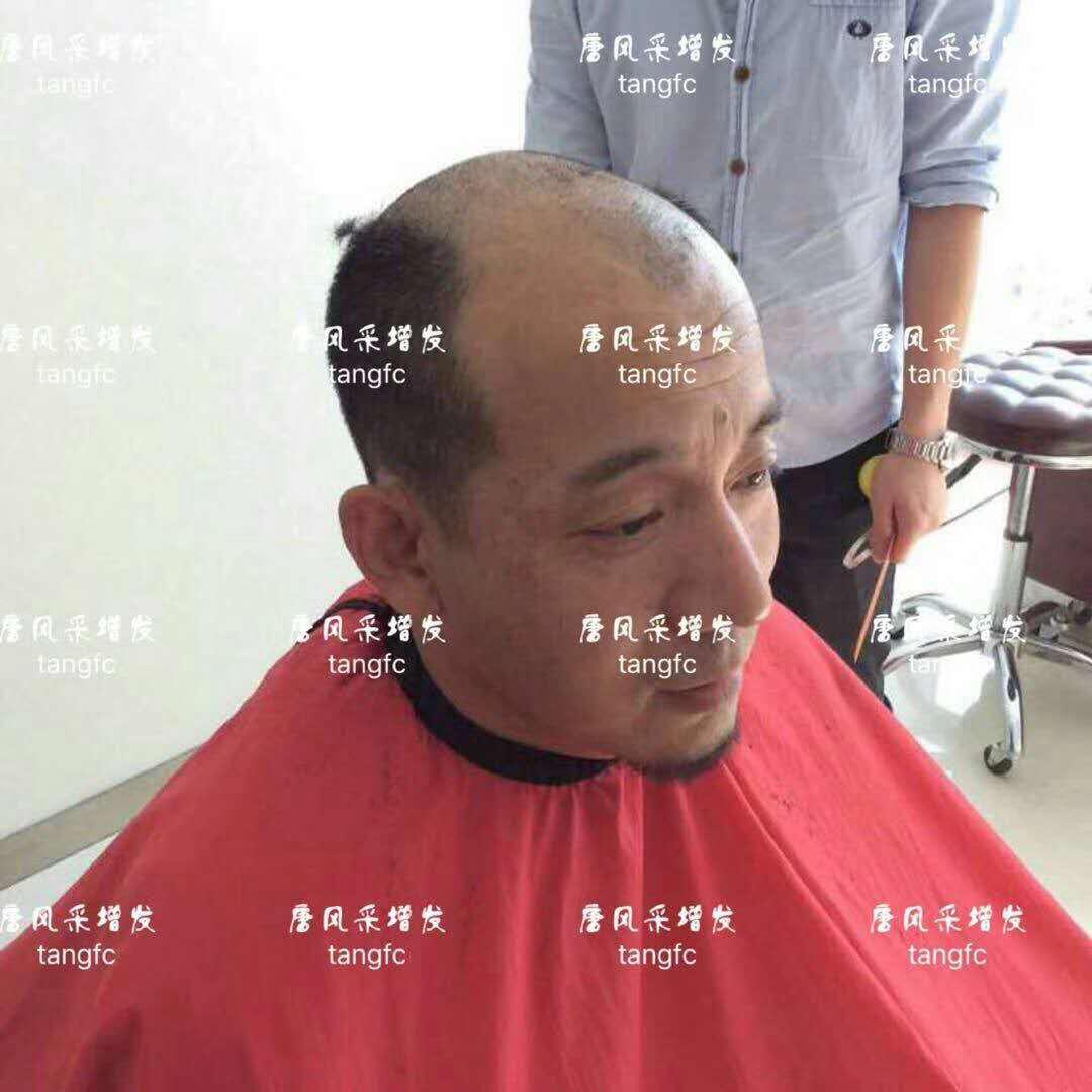  生發(fā)了這么久，但凡有效果的也該有些跡象了